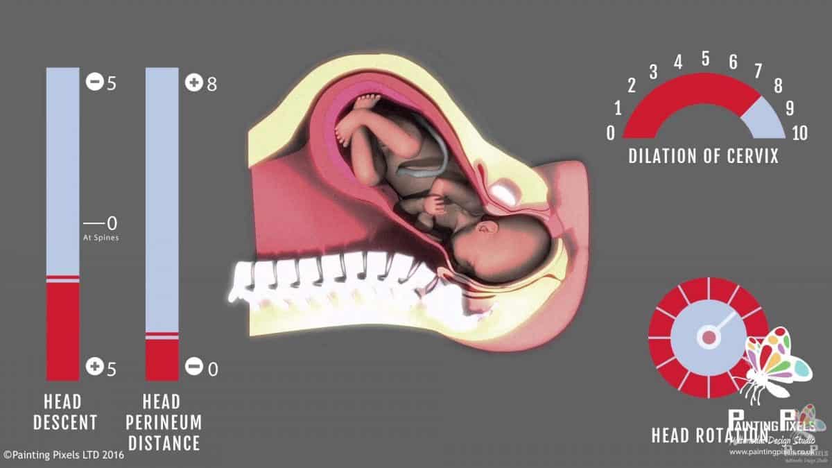 Ultrasound 3D Animation